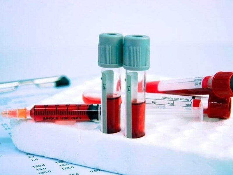 Аналіз крові: зрозуміле розшифрування характеристик